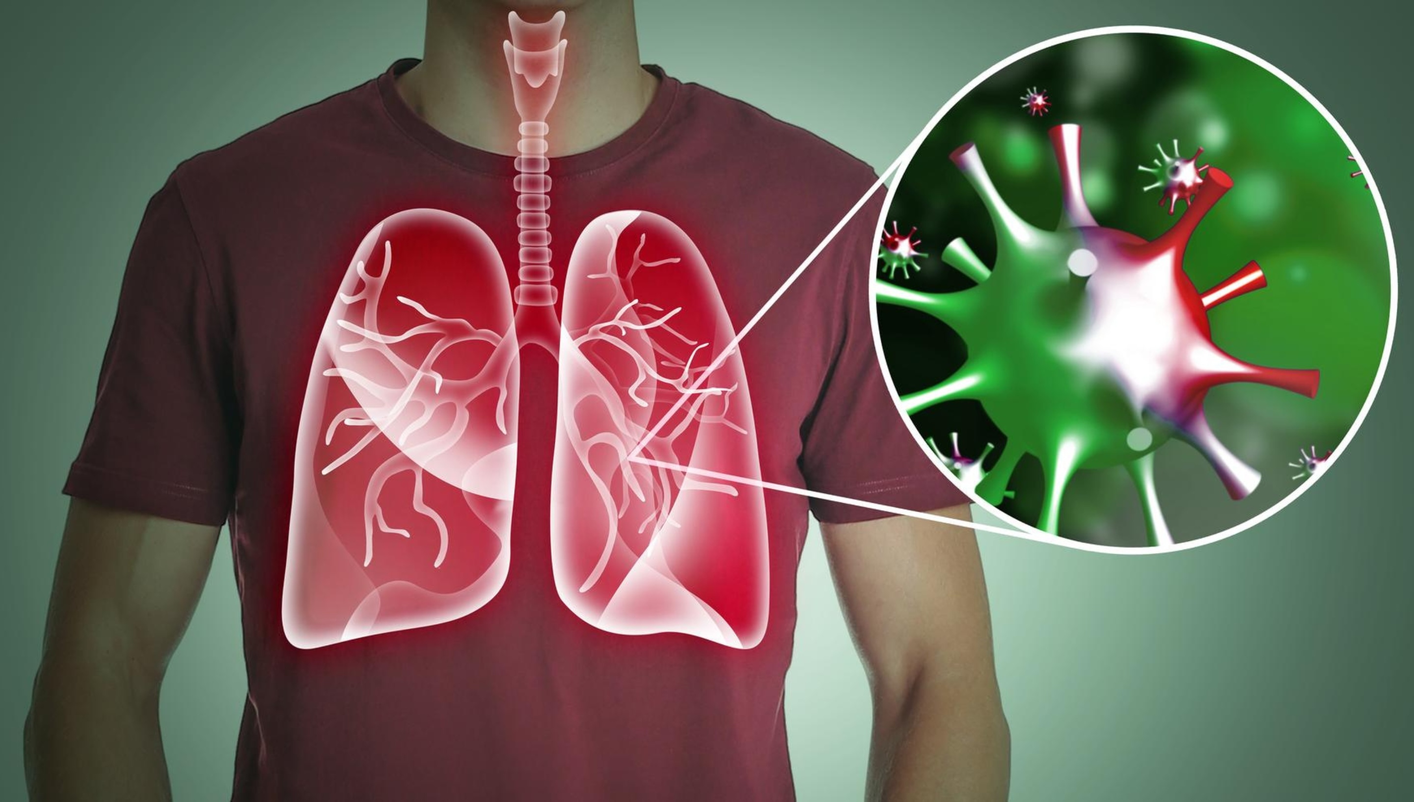 Respiratory Allergies treated holistically at The LifeCareWellness Centre, Ontario, Canada